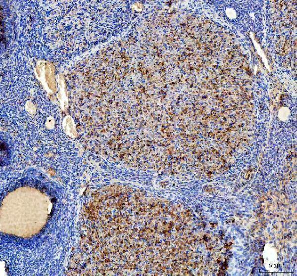 a09470 1 strip1 primary antibodies ihc testing 3_1