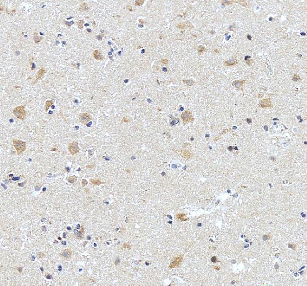 IHC analysis of STRIP1 using anti-STRIP1 antibody (A09470-1)