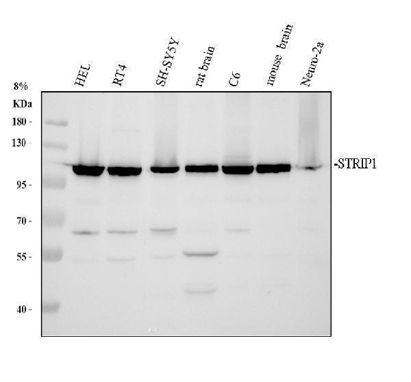 Western blot analysis of STRIP1 using anti-STRIP1 antibody (A09470-1)