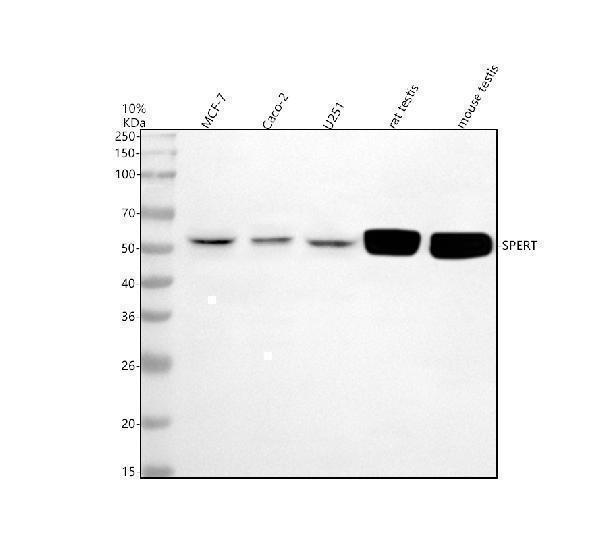  Western blot analysis of CBY2 using anti-CBY2 antibody (A09473-2)