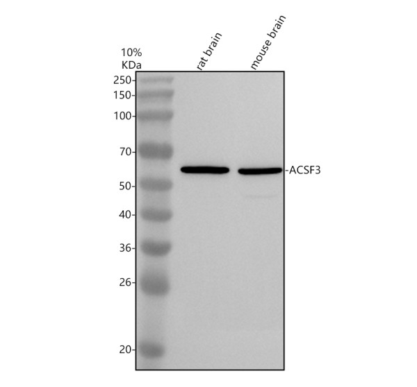 Western blot analysis of ACSF3 using anti-ACSF3 antibody (A09475-1)