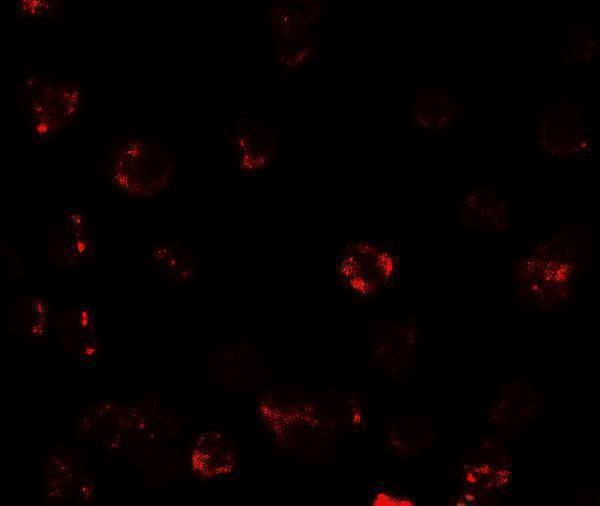 a09477 tespa1 primary antibodies if testing 3