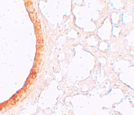 a09478 slc39a3 primary antibodies ihc testing 2