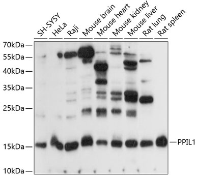 a09483 ppil1 primary antiboties wb testing 1
