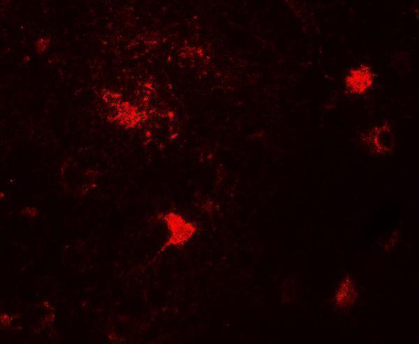 Immunofluorescence of DPF3 in human brain tissue with DPF3 antibody at 20 μg/mL
