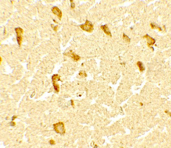 Immunohistochemistry of DPF3 in human brain tissue with DPF3 antibody at 5 μg/mL