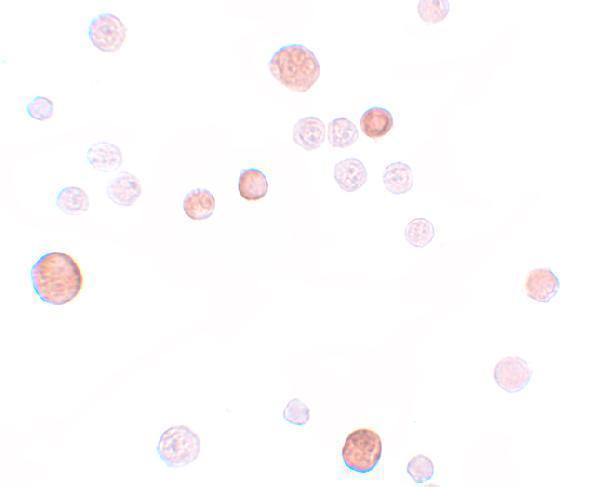 Immunocytochemistry of PLAC1 in HeLa cells with PLAC1 antibody at 10 μg/mL