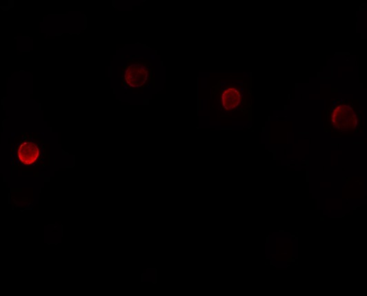 Immunofluorescence of PLAC1 in Hela cells with PLAC1 antibody at 20 μg/mL