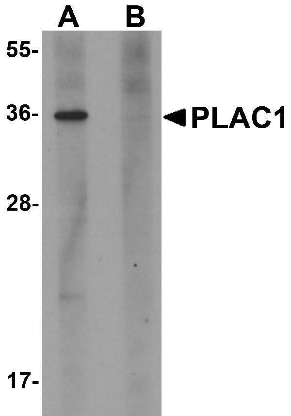 Western blot analysis of PLAC1 in human placenta tissue lysate with PLAC1 antibody at 1 μg/mL in (A) the absence and (B) the presence of blocking peptide