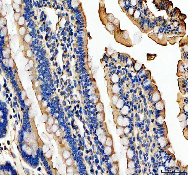a09489 2 guca2b primary antibodies ihc testing 3