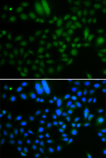 a09491 alkbh8 primary antiboties if testing 3