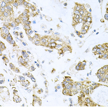 a09491 alkbh8 primary antiboties ihc testing 1