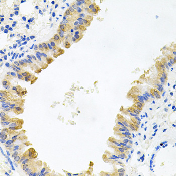 a09491 alkbh8 primary antiboties ihc testing 2