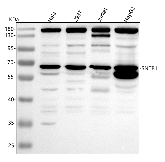a09492 3 stnb1 primary antibodies wb testing 1