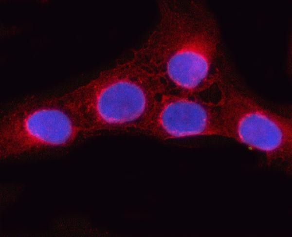 IF analysis of OSBPL9 using anti-OSBPL9 antibody (A09498-1)
