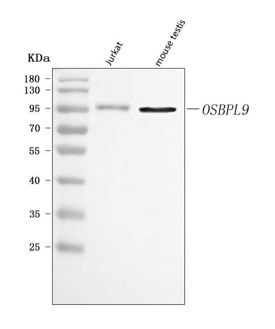  Western blot analysis of OSBPL9 using anti-OSBPL9 antibody (A09498-1)