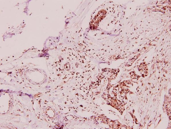 a09503 apol2 primary antiboties ihc testing 2