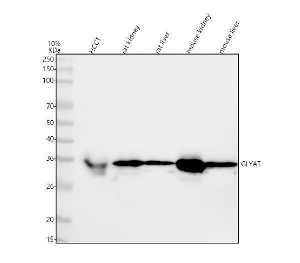  Western blot analysis of GLYAT using anti-GLYAT antibody (A09506-1)