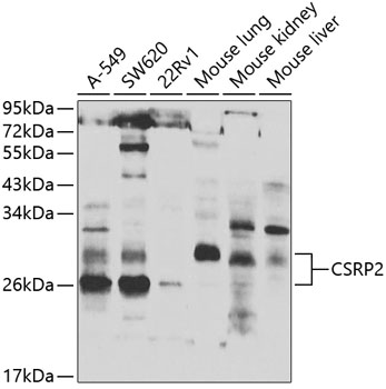 Western blot analysis of extracts of various cell lines, using CSRP2 antibody  at 1:1000 dilution