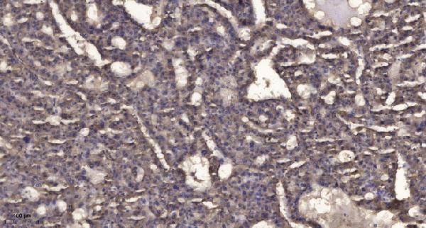 a09509 1 scfd1 primary antibodies ihc testing 1