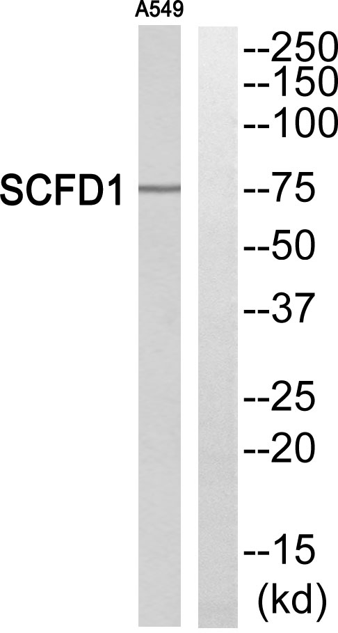 Western blot analysis of SCFD1 Antibody