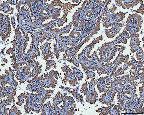 a09514 5 trim16 primary antibodies ihc testing 5