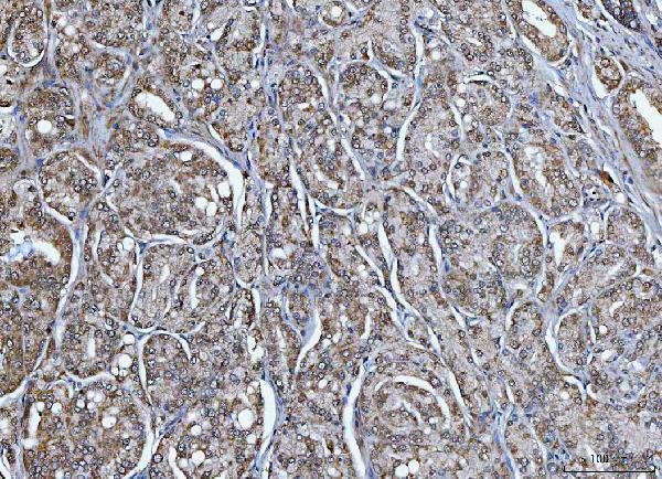 a09514 5 trim16 primary antibodies ihc testing 7