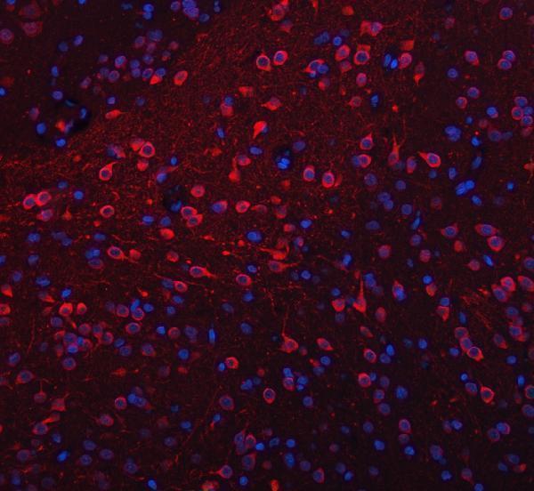 a09518 trank1 primary antibodies if testing 10