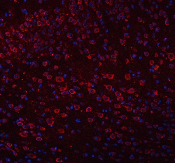 a09518 trank1 primary antibodies if testing 9