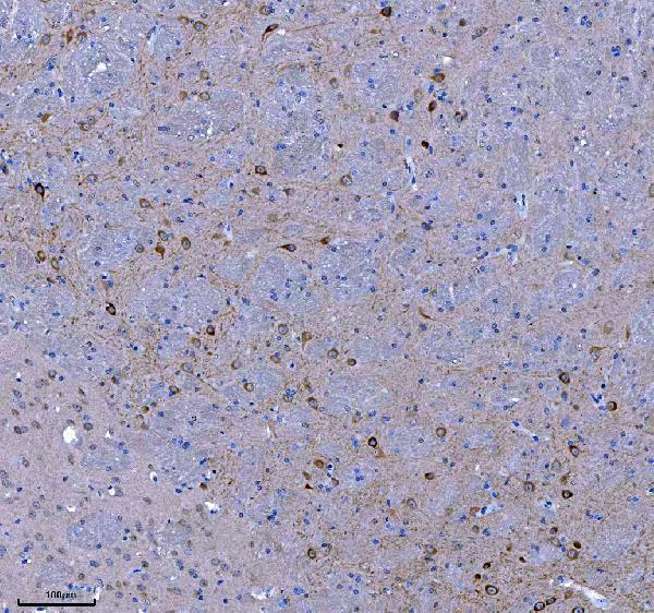 a09518 trank1 primary antibodies ihc testing 3
