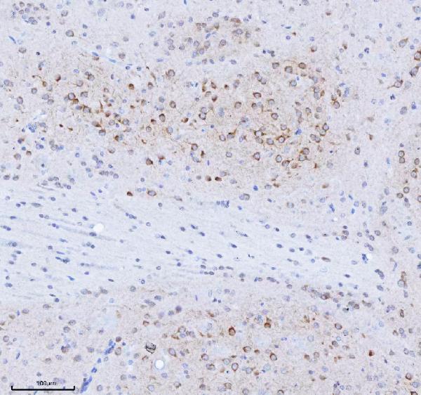 a09518 trank1 primary antibodies ihc testing 4