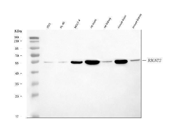  Western blot analysis of B3GNT2 using anti-B3GNT2 antibody (A09524-1)