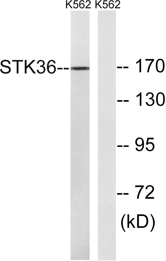 Western blot analysis of lysates from K562 cells, using STK36 Antibody