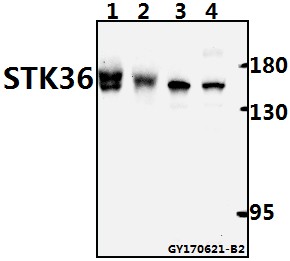 Western blot (WB) analysis of STK36 polyclonal antibody at 1:500 dilution
Lane1:The Testis tissue lysate of Mouse(40ug)
Lane2:The Testis tissue lysate of Rat(40ug)
Lane3:L02 whole cell lysate(40ug)
Lane4:A549 whole cell lysate(40ug)
