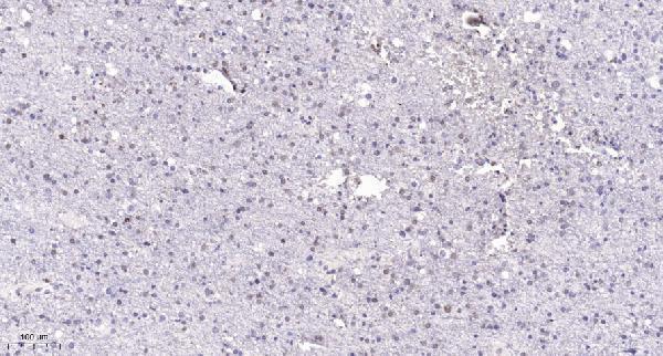 Immunohistochemical analysis of paraffin-embedded human brain