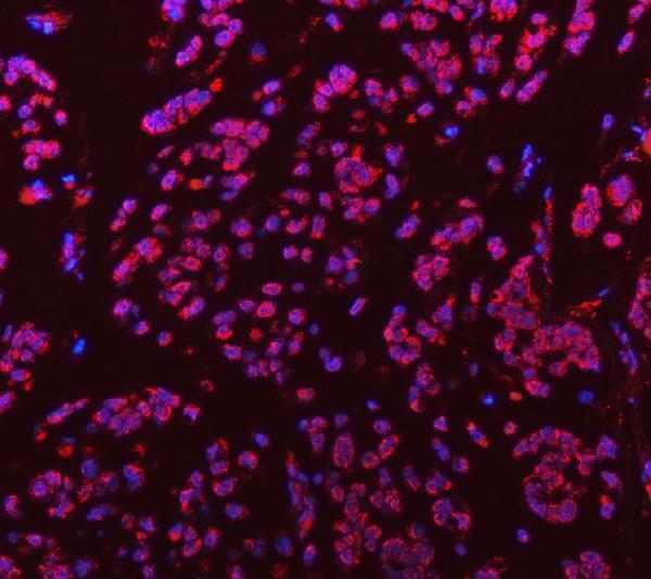 a09533 1 snrpd3 primary antibodies if testing 8