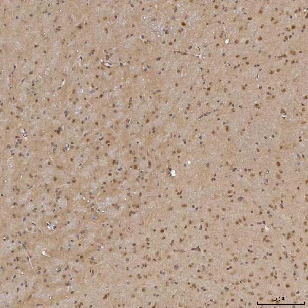  IHC analysis of Sm-D3/SNRPD3 using anti-Sm-D3/SNRPD3 antibody (A09533-1)