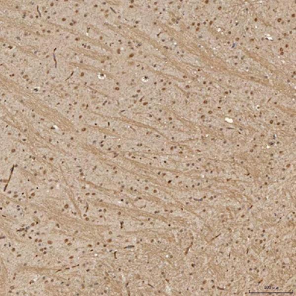  IHC analysis of Sm-D3/SNRPD3 using anti-Sm-D3/SNRPD3 antibody (A09533-1)