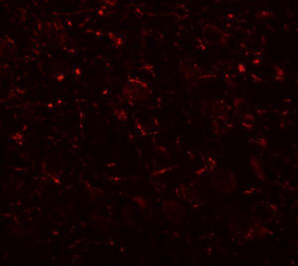 Immunofluorescence of AP3B2 in mouse brain tissue with AP3B2 antibody at 20 μg/mL