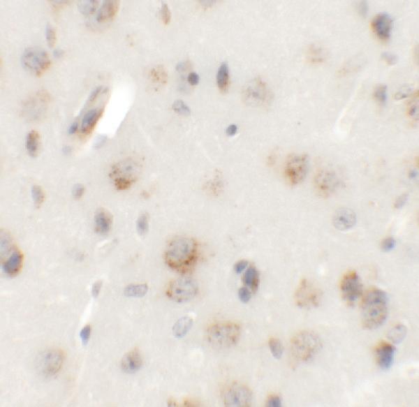 Immunohistochemistry of AP3B2 in mouse brain tissue with AP3B2 antibody at 5 μg/mL