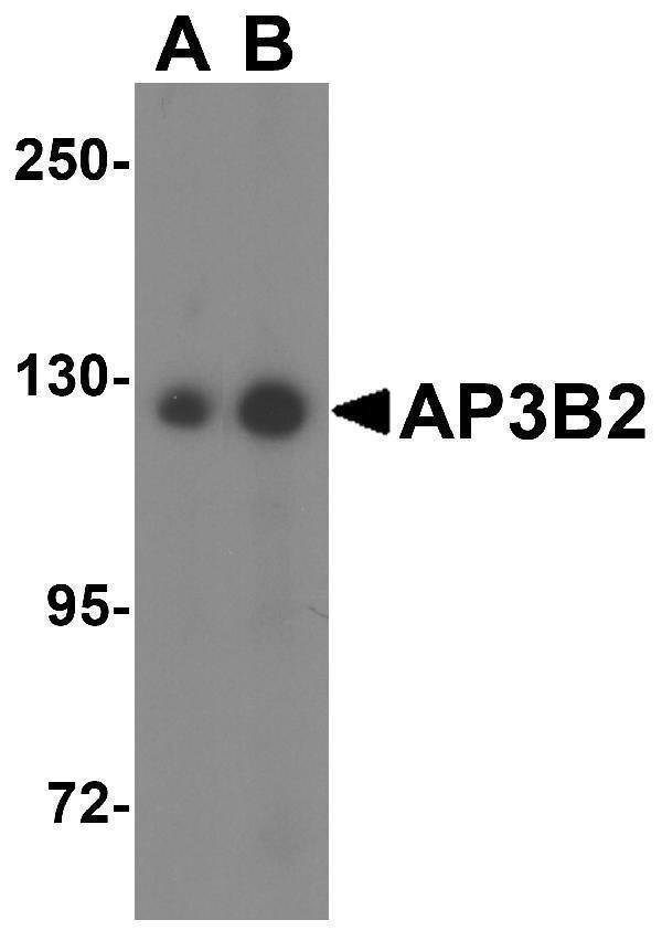 Western blot analysis of AP3B2 in rat brain tissue lysate with AP3B2 antibody at (A) 1 and (B) 2 μg/mL