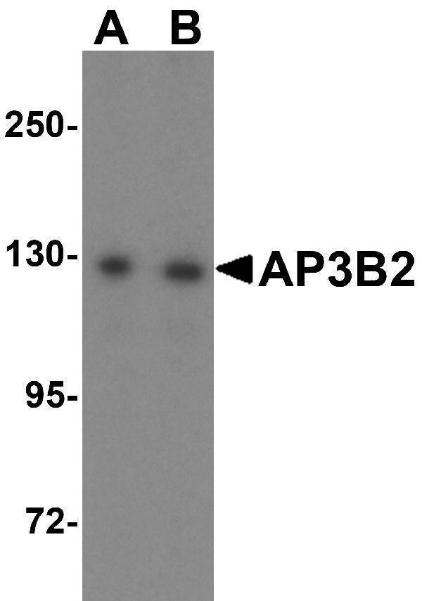 a09539 ap3b2 primary antibodies wb testing 4