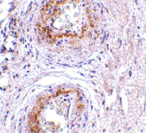 a09540 gpr124 primary antibodies ihc testing 2
