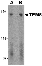 a09540 gpr124 primary antibodies wb testing 1
