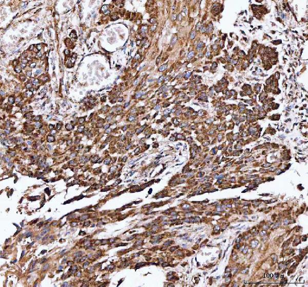 a09544 3 idh3a primary antibodies ihc testing 2