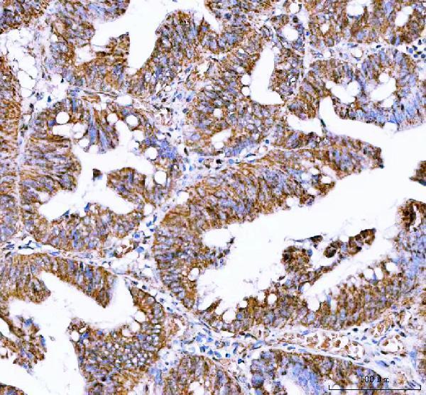a09544 3 idh3a primary antibodies ihc testing 3