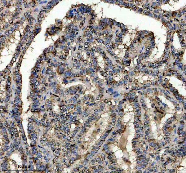IHC analysis of HSCB using anti-HSCB antibody (A09549-1)