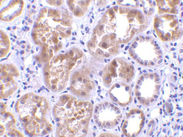 a09550 1 c1qtnf1 primary antibodies ihc testing 2