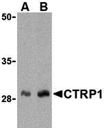 a09550 1 c1qtnf1 primary antibodies wb testing 1