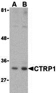 Western blot analysis of CTRP1 in MDA-MD-361 cell lysate with CTRP1 (IN) antibody at (A) 1 and (B) 2 μg/mL